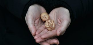 Аборт. Иллюстративное изображение: Getty Images