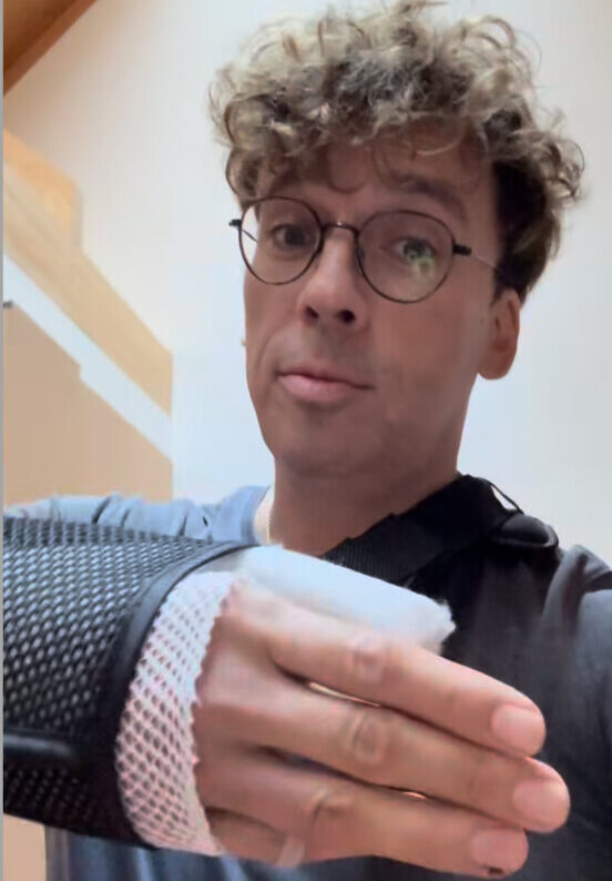 Проснулся – гипс»… Максим Галкин попал в аварию в Юрмале - Chayka.lv